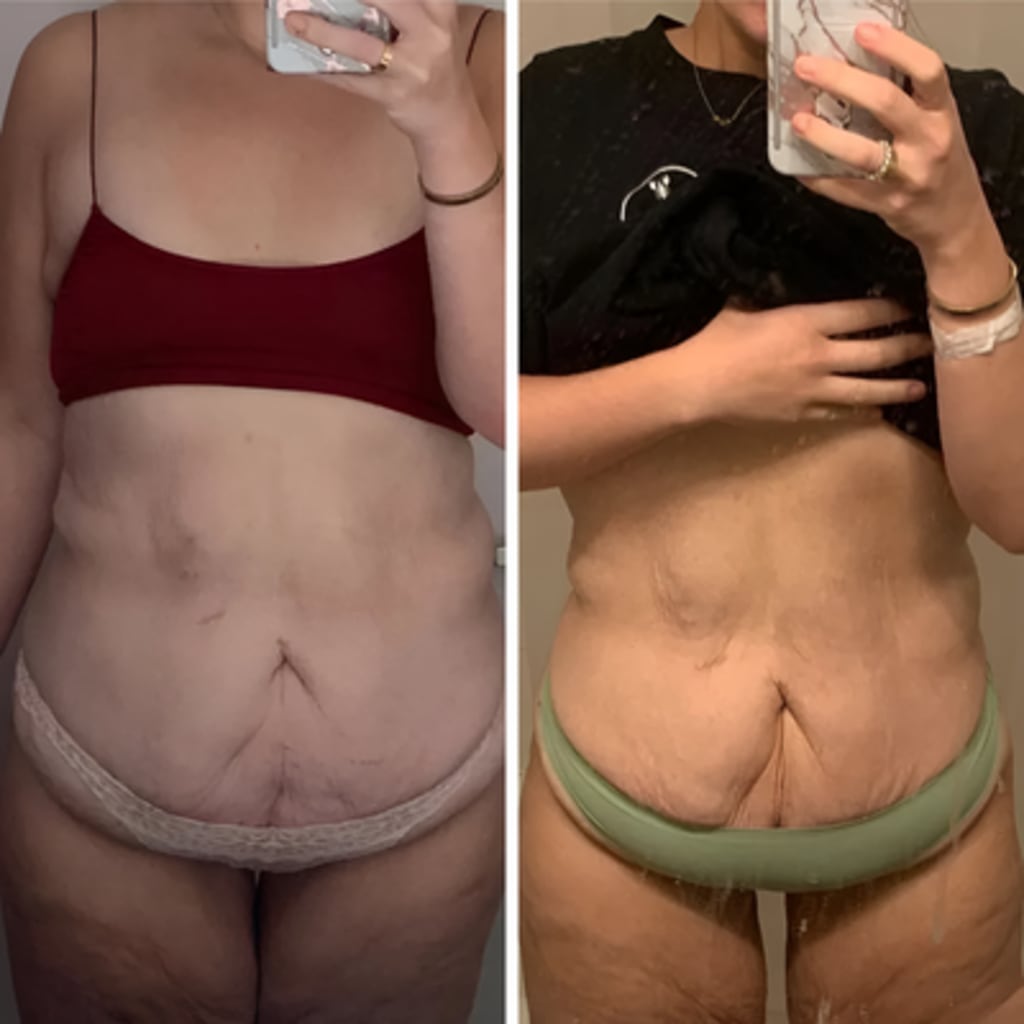 Body Sculpting Kit v2