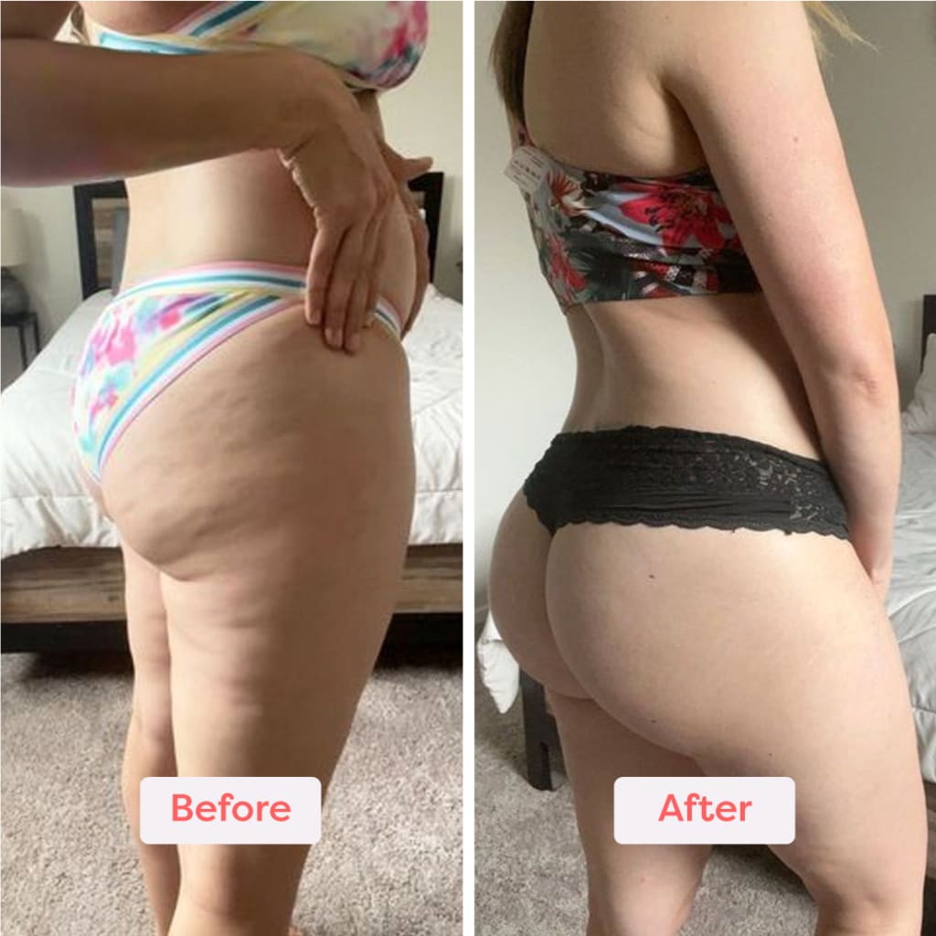 Body Sculpting Kit v2